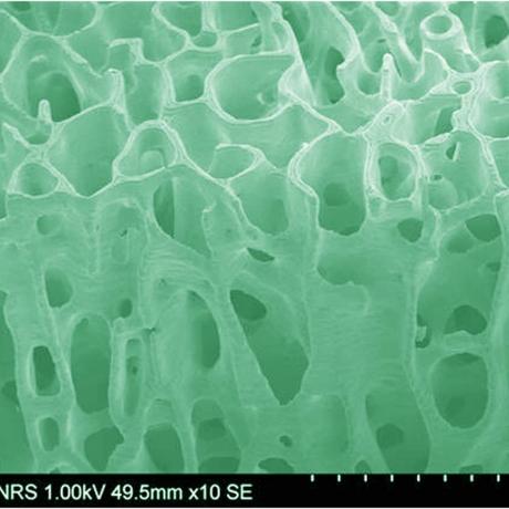 Example of 3D biotechnology structure: trabecular bone
